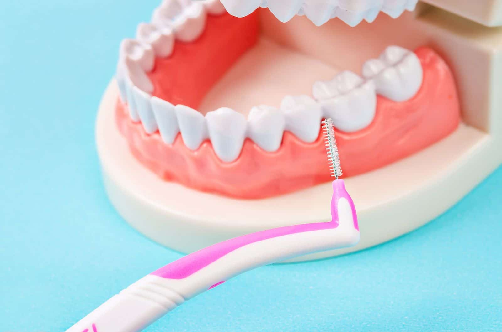 Como Usar El Cepillo Interdental Correctamente Dental Solutions Tijuana